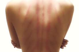 Massage Guasha